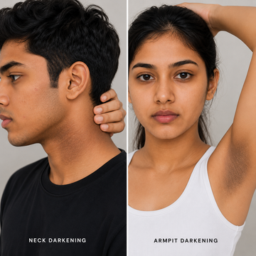 Neck/Armpit Darkening